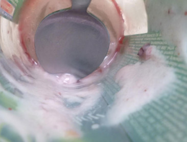 Test-Aankoop klaagt misleidend fruit op etiketten aan