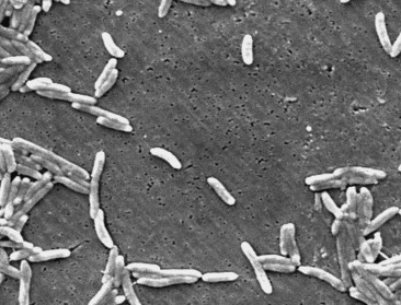 "Resistente bacteriën zetten hun opmars voort"