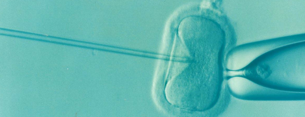 ivf-1514174_1280