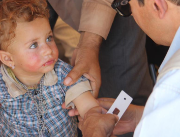 Unicef: Ontheemde kinderen in Syrië ernstig ondervoed